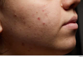  Photos Jennifer Larsen HD Face skin references cheek skin pores skin texture 0005.jpg